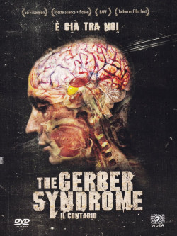 Gerber Syndrome (The)