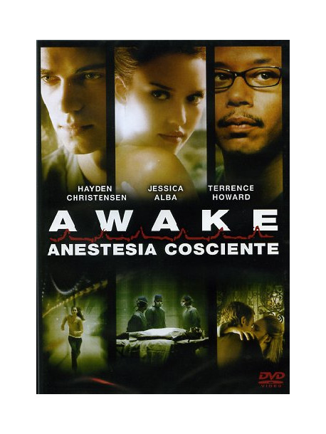 Awake - Anestesia Cosciente