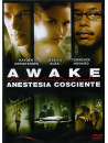 Awake - Anestesia Cosciente