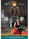 Bellini - Norma  - Arrivabeni/Theodossiou/Ventre/Barcellona (2 Dvd)