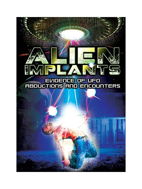 Alien Implants Evidence Of Ufo Abductions And Encounters [Edizione: Regno Unito]