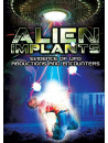 Alien Implants Evidence Of Ufo Abductions And Encounters [Edizione: Regno Unito]