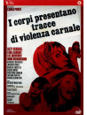 Corpi Presentano Tracce Di Violenza Carnale (I)