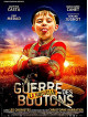 La Nouvelle Guerre Des Boutons (2 Dvd) [Edizione: Francia]