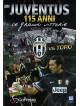 Juventus Vs Torino
