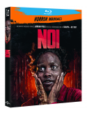 Noi
