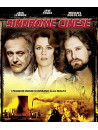 Sindrome Cinese