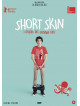 Short Skin